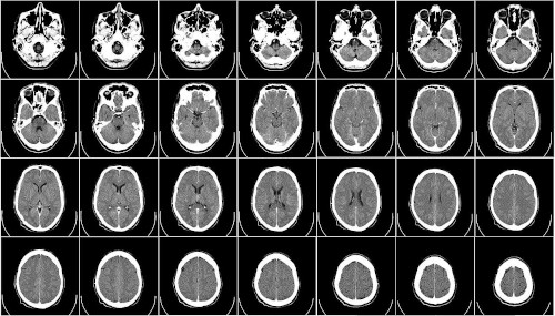 Praxissoftware für Radiologie: CT eines Gehirns